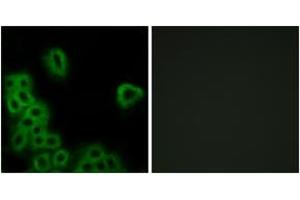 Immunofluorescence analysis of MCF7 cells, using PE2R4 Antibody. (PTGER4 Antikörper  (AA 321-370))
