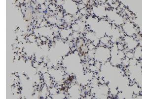 ABIN6272933 at 1/100 staining Mouse lung tissue by IHC-P. (TET2 Antikörper  (Internal Region))