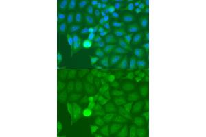 Immunofluorescence analysis of A549 cells using IRAK2 antibody. (IRAK2 Antikörper)