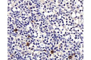 Immunohistochemistry analysis of paraffin-embedded rat lymph node using BAG2 Polyclonal Antibody at dilution of 1:400. (BAG2 Antikörper)