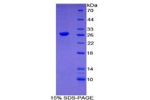SDS-PAGE analysis of Mouse CLEC10A Protein. (CLEC10A Protein)