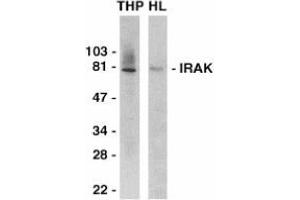 Western blot analysis of IRAK in THP-1 (THP) and HeLa (HL) whole cell lysates with AP30438PU-N IRAK antibody at 1/2000 dilution. (IRAK1 Antikörper  (C-Term))