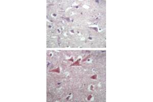 Immunohistochemical analysis of TUBB2A in paraffin-embedded formalin-fixed human brain tissue using an isotype control (top) and TUBB2A polyclonal antibody  (bottom) at 5 ug/mL . (TUBB2A Antikörper  (AA 417-435))