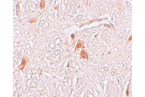 Immunohistochemical staining of human brain cells with LOC729993 polyclonal antibody  at 2. (Shisa9 Antikörper  (Internal Region))