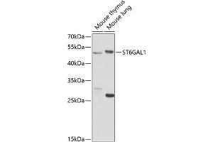 Western blot analysis of extracts of various cell lines, using ST6G antibody (ABIN6130083, ABIN6148536, ABIN6148538 and ABIN6221427) at 1:1000 dilution. (ST6GAL1 Antikörper  (AA 27-200))