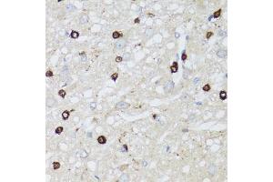 Immunohistochemistry of paraffin-embedded rat brain using MIP antibody (ABIN5971491) at dilution of 1/100 (40x lens). (MIP Antikörper)