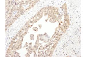 Immunohistochemistry (IHC) image for anti-Proteasome (Prosome, Macropain) 26S Subunit, ATPase, 4 (PSMC4) (AA 1-50) antibody (ABIN7454973)