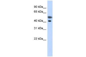 WB Suggested Anti-TMOD2 Antibody Titration: 0. (TMOD2 Antikörper  (N-Term))