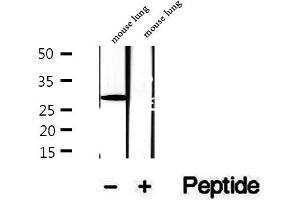 Western Blotting (WB) image for anti-Deiodinase, Iodothyronine, Type I (DIO1) (C-Term) antibody (ABIN6261300)