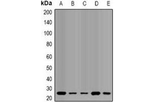 Western blot analysis of QDPR expression in HL60 (A), SW620 (B), mouse liver (C), mouse brain (D), rat liver (E) whole cell lysates.