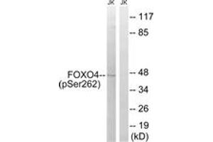 Western blot analysis of extracts from Jurkat cells treated with starved 24h, using FOXO4 (Phospho-Ser262) Antibody. (FOXO4 Antikörper  (pSer262))