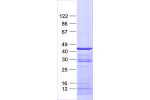 Validation with Western Blot (NCF4 Protein (His tag))