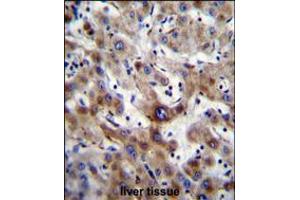 SLC25A6 Antibody immunohistochemistry analysis in formalin fixed and paraffin embedded human liver tissue followed by peroxidase conjugation of the secondary antibody and DAB staining. (SLC25A6 Antikörper  (AA 128-155))