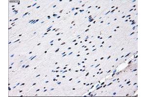 Image no. 15 for anti-Replication Protein A2, 32kDa (RPA2) antibody (ABIN1500735)