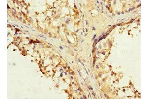 Immunohistochemistry (IHC) image for anti-Interleukin 28 Receptor, alpha (Interferon, lambda Receptor) (IL28RA) (AA 21-228) antibody (ABIN6098644)