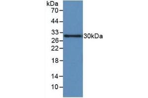 Detection of Recombinant IGFBP1, Human using Monoclonal Antibody to Insulin Like Growth Factor Binding Protein 1 (IGFBP1) (IGFBPI Antikörper  (AA 36-235))