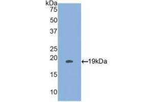 Western blot analysis of recombinant Human HSPb3. (HSPB3 Antikörper  (AA 1-150))