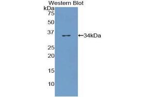 Western Blotting (WB) image for anti-Collagen, Type VII (COL7) (AA 190-472) antibody (ABIN1175574) (COL7 Antikörper  (AA 190-472))