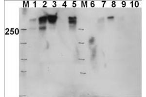 Western blot using  Affinity Purified anti-DNAPKcs antibody shows detection of a 460 kDa band corresponding to human DNAPKcs in various preparations. (PRKDC Antikörper  (pThr2609))
