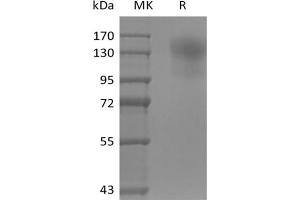 Western Blotting (WB) image for Protein tyrosine Phosphatase, Receptor Type, C (PTPRC) protein (His tag) (ABIN7320923) (CD45 Protein (His tag))