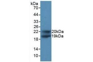 Detection of Recombinant CDKN1A, Human using Polyclonal Antibody to Cyclin Dependent Kinase Inhibitor 1A (CDKN1A) (p21 Antikörper  (AA 1-164))