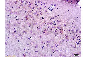 Formalin-fixed and paraffin embedded rat brain tissue labeled Anti-MRP1 Polyclonal Antibody, Unconjugated (ABIN671526) at 1:200, followed by conjugation to the secondary antibody and DAB staining (MRP1 Antikörper  (AA 501-600))