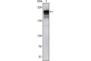 Western blot analysis using PDGFRβ mouse mAb against NIH/3T3 cell lysate (1). (PDGFRB Antikörper)