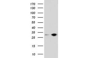 Western Blotting (WB) image for anti-Sepiapterin Reductase (SPR) antibody (ABIN1501114) (SPR Antikörper)