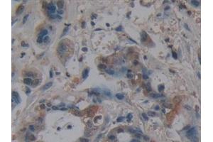 Immunohistochemistry (IHC) image for anti-Villin 1 (VIL1) (AA 1-320) antibody (ABIN7435034)