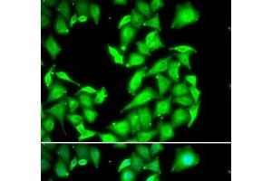 Immunofluorescence analysis of HeLa cells using PPM1A Polyclonal Antibody (PPM1A Antikörper)