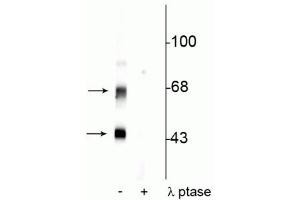 Western blot of rat brain lysate showing specific immunolabeling of the ~50 kDa α- and the ~60 kDa β-CaM Kinase II phosphorylated at Thr306 in the first lane (-). (CaMKII alpha/beta (pThr306) Antikörper)