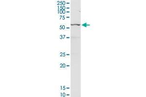 CHEK2 MaxPab rabbit polyclonal antibody. (CHEK2 Antikörper  (AA 1-543))