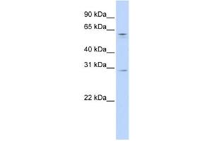 Western Blotting (WB) image for anti-REC8 Homolog (Yeast) (REC8) antibody (ABIN2459159) (REC8 Antikörper)
