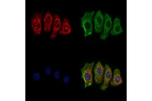 NDUFAF2 Antibody staining HepG2 cells by IF/ICC.