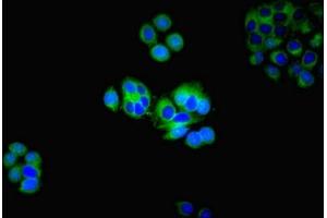Immunofluorescent analysis of PC-3 cells using ABIN7142622 at dilution of 1:100 and Alexa Fluor 488-congugated AffiniPure Goat Anti-Rabbit IgG(H+L) (HTR2A Antikörper  (AA 385-471))