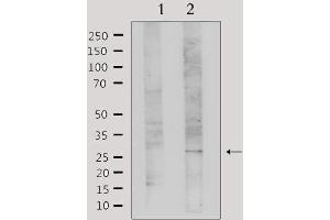 Western blot analysis of extracts from Hela, using Galectin 3 Antibody. (Galectin 3 Antikörper  (Internal Region))