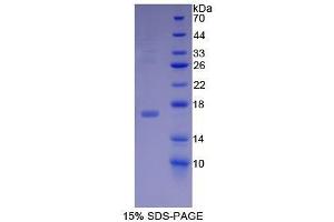 SDS-PAGE (SDS) image for Midkine (Neurite Growth-Promoting Factor 2) (MDK) (AA 22-140) protein (His tag) (ABIN1080293) (Midkine Protein (AA 22-140) (His tag))
