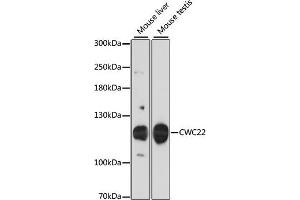 Western blot analysis of extracts of various cell lines, using CWC22 antibody (ABIN6132141, ABIN6139263, ABIN6139264 and ABIN6216988) at 1:3000 dilution. (CWC22 Antikörper  (AA 639-908))