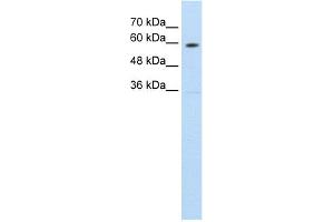 WB Suggested Anti-SLC11A1 Antibody Titration:  1. (SLC11A1 Antikörper  (C-Term))