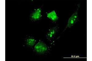 Immunofluorescence of monoclonal antibody to THG-1 on HeLa cell. (TSC22D4 Antikörper  (AA 1-395))