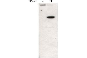 Image no. 1 for anti-Signal Transducer and Activator of Transcription 2, 113kDa (STAT2) (N-Term), (pTyr690) antibody (ABIN401443) (STAT2 Antikörper  (N-Term, pTyr690))