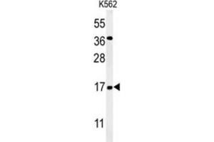 Western Blotting (WB) image for anti-N(alpha)-Acetyltransferase 50, NatE Catalytic Subunit (NAA50) antibody (ABIN3002220) (NAA50 Antikörper)