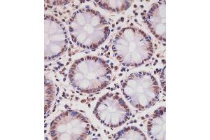 (ABIN6242630 and ABIN6577239) staining SD1 in hun colon tissue sections by Immunohistochemistry (IHC-P - paraforldehyde-fixed, paraffin-embedded sections). (SMAD1 Antikörper  (AA 20-330))