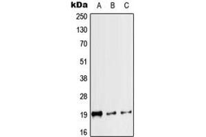 Western blot analysis of Calcitonin expression in HEK293T (A), mouse heart (B), rat heart (C) whole cell lysates. (Calcitonin Antikörper  (Center))