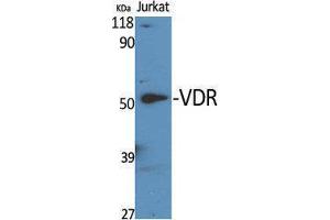Western Blotting (WB) image for anti-Vitamin D Receptor (VDR) (Tyr307) antibody (ABIN3187461) (Vitamin D Receptor Antikörper  (Tyr307))