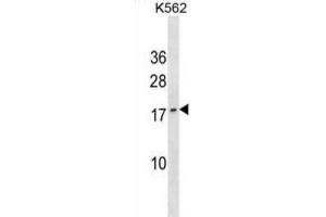 Western Blotting (WB) image for anti-GTP Cyclohydrolase I Feedback Regulator (GCHFR) antibody (ABIN3000608) (GCHFR Antikörper)