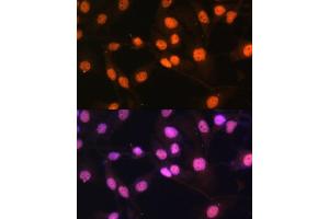 Immunofluorescence (IF) image for anti-Lysine (K)-Specific Demethylase 1A (KDM1A) (AA 130-380) antibody (ABIN7268323)