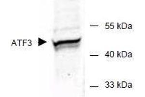 Image no. 2 for anti-Activating Transcription Factor 3 (ATF3) (AA 113-130) antibody (ABIN401262) (ATF3 Antikörper  (AA 113-130))
