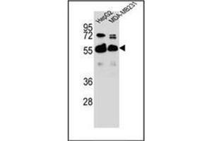 Western blot analysis of RAP1GDS1 Antibody  in HepG2,MDA-MB231 cell line lysates (35ug/lane). (RAP1GDS1 Antikörper  (Middle Region))