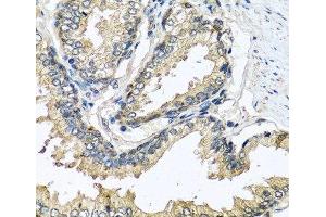 Immunohistochemistry of paraffin-embedded Human prostate using CST1 Polyclonal Antibody at dilution of 1:100 (40x lens). (CST1 Antikörper)